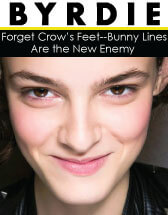 How To Treat Bunny Lines Around Your Nose!